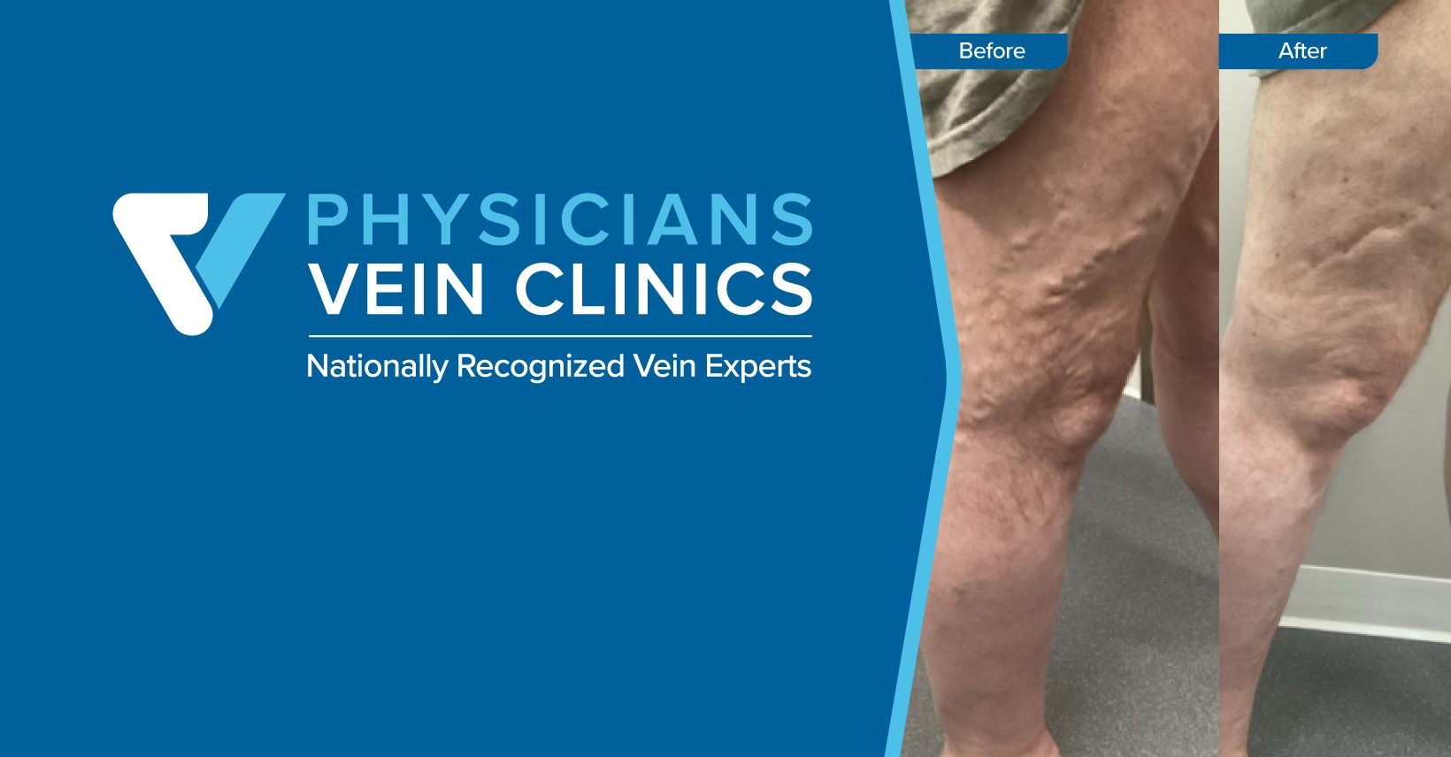 Physician Vein Clinics