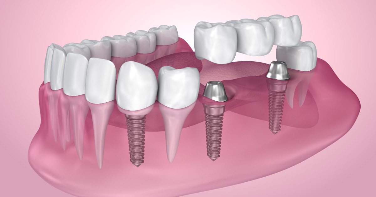 Toothopia Dental Clinic