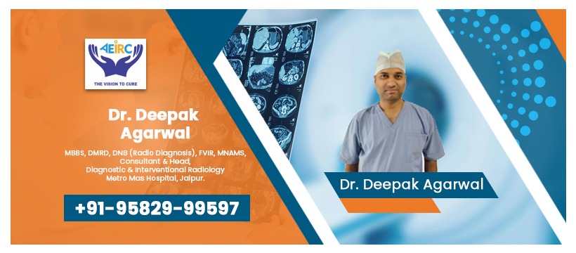 Varicocele Treatment in Jaipur | Dr. Deepak Agarwal