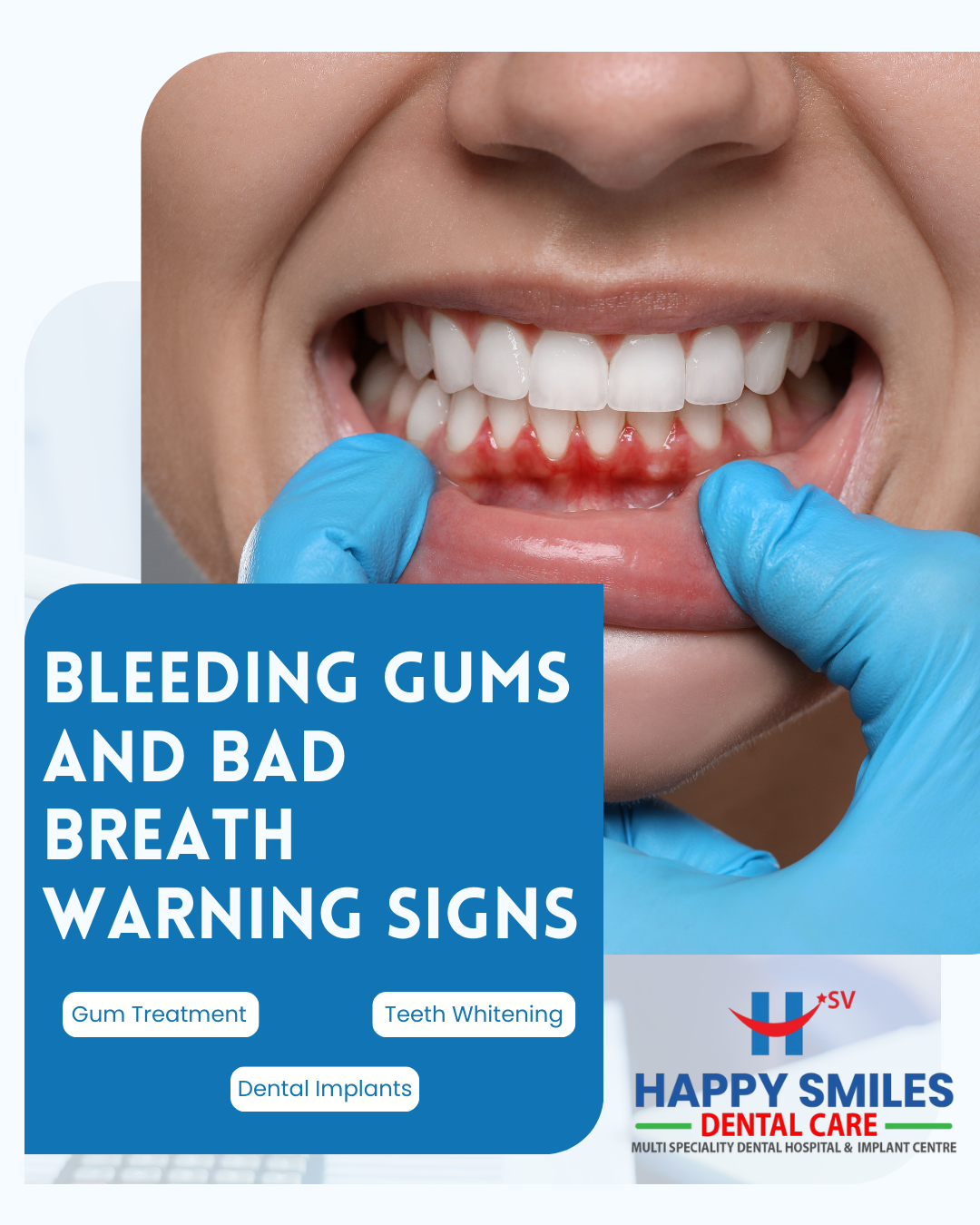 happysmilesdentalhospital