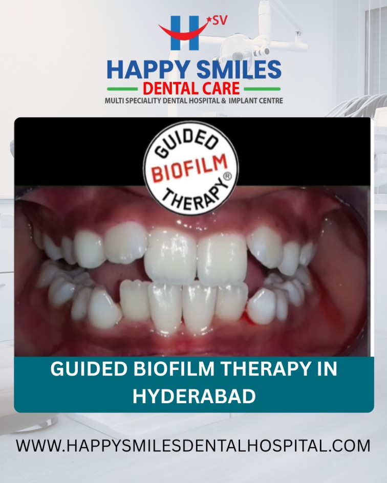 Affordable Guided Biofilm Therapy Cost in Hyderabad – Modern Dental Cleaning Solution