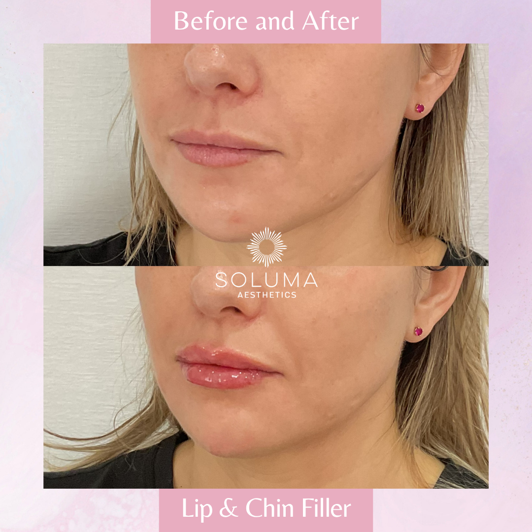 Soluma Aesthetics Med Spa - Oviedo - Gallery 20