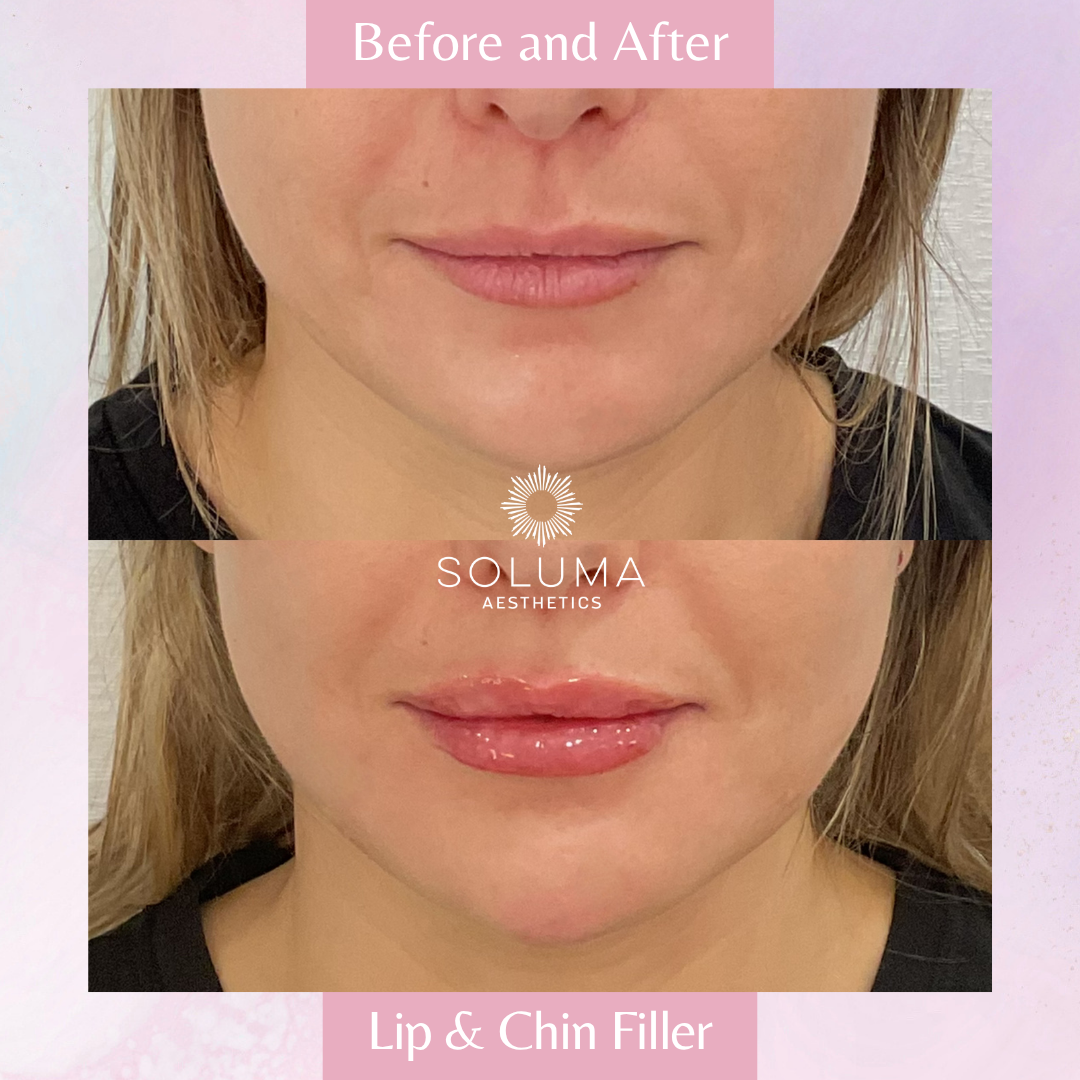 Soluma Aesthetics Med Spa - Oviedo - Gallery 22