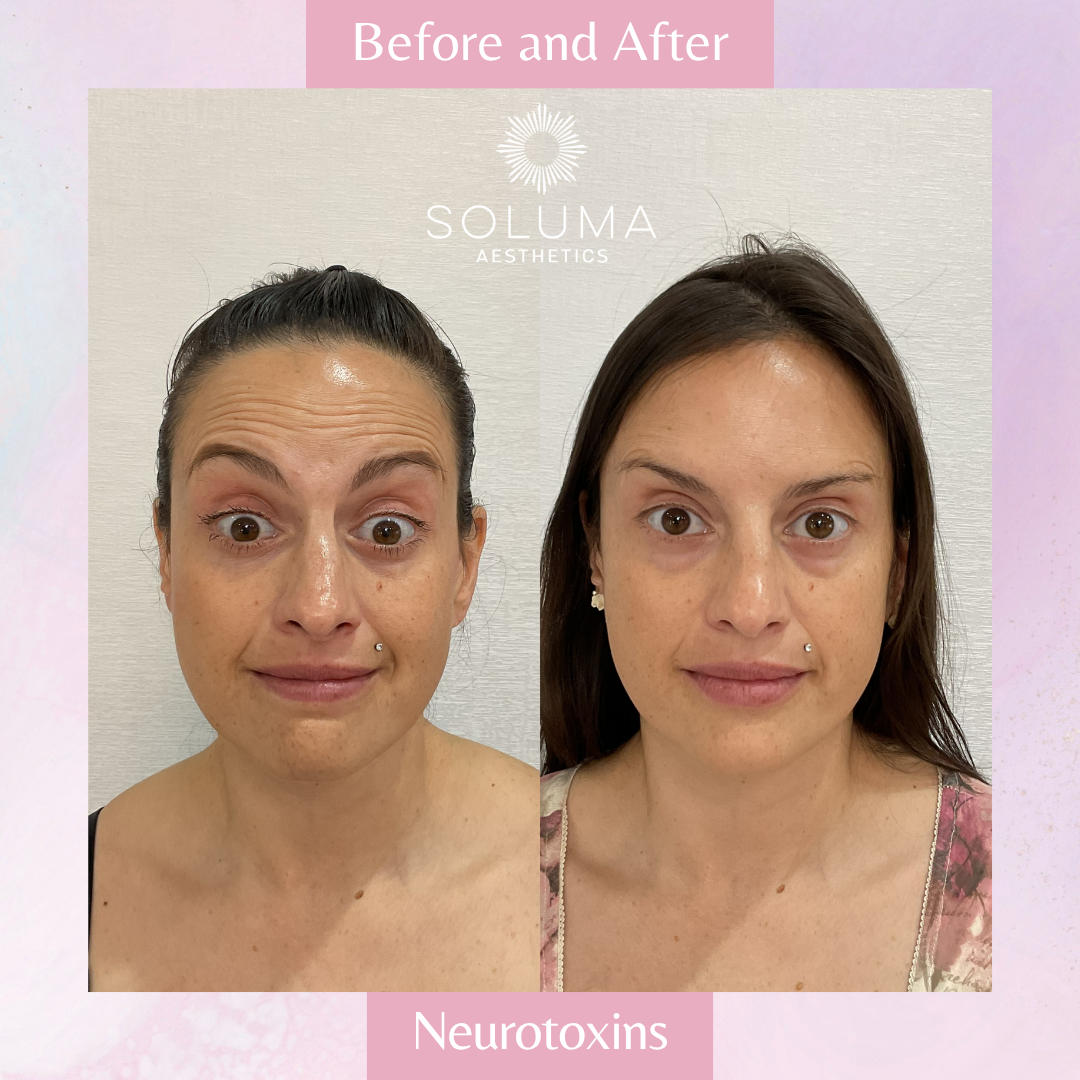 Soluma Aesthetics Med Spa - Oviedo - Gallery 23