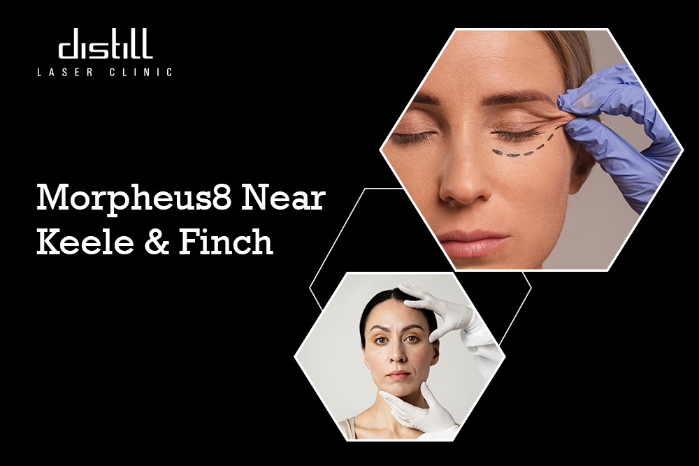 Distill Laser Clinic - Gallery 2