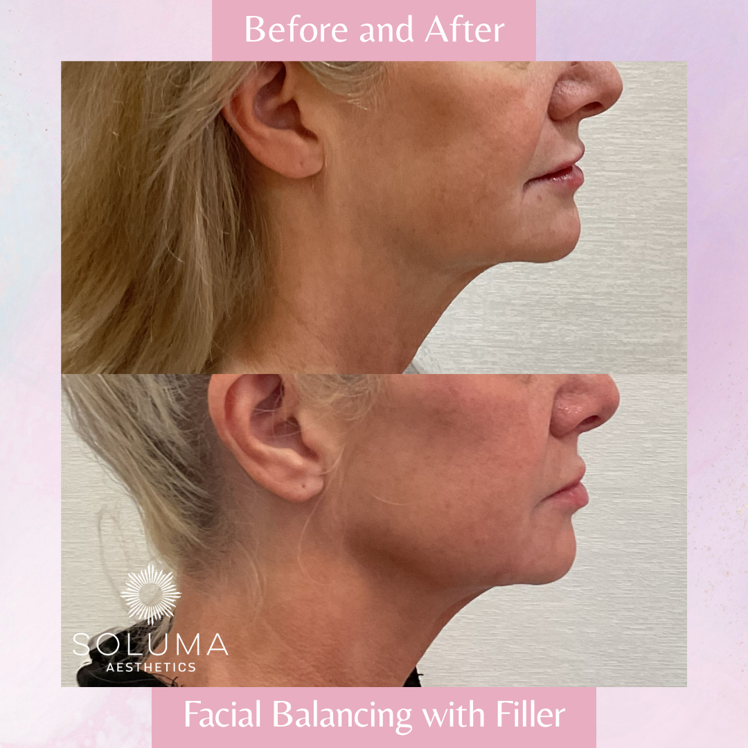 Soluma Aesthetics Med Spa - Oviedo - Gallery 13