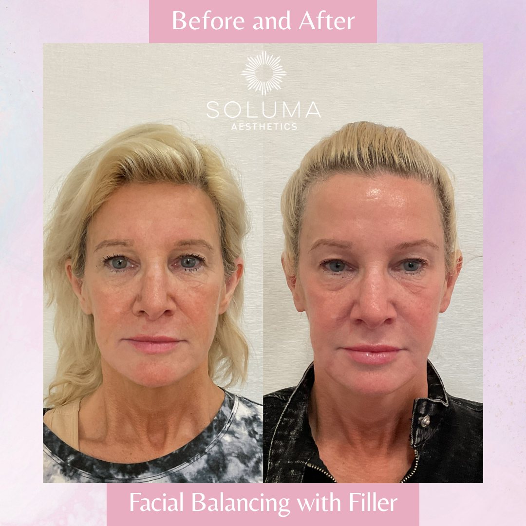 Soluma Aesthetics Med Spa - Oviedo - Gallery 14