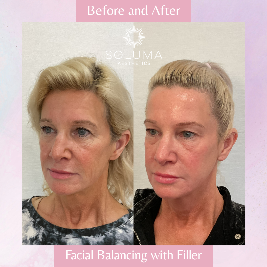 Soluma Aesthetics Med Spa - Oviedo - Gallery 15
