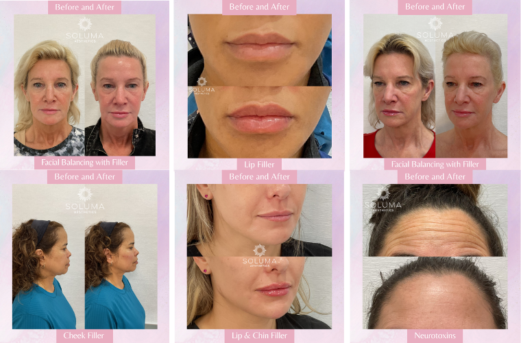 Soluma Aesthetics Med Spa - Gallery 2