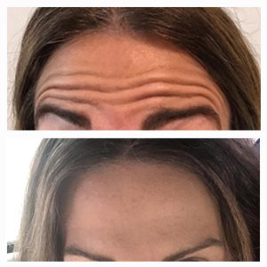 Skin & Laser Clinic Armadale, Melbourne - Gallery 2