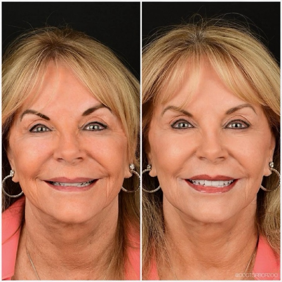 Dr. Borzoo Ahmadi DDS - Cosmetic Dentist - Gallery 1