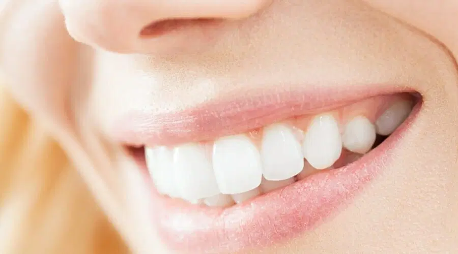 Meadows Dental Group - Gallery 5