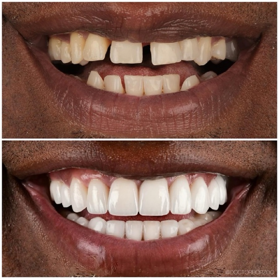 Dr. Borzoo Ahmadi DDS - Cosmetic Dentist - Gallery 2