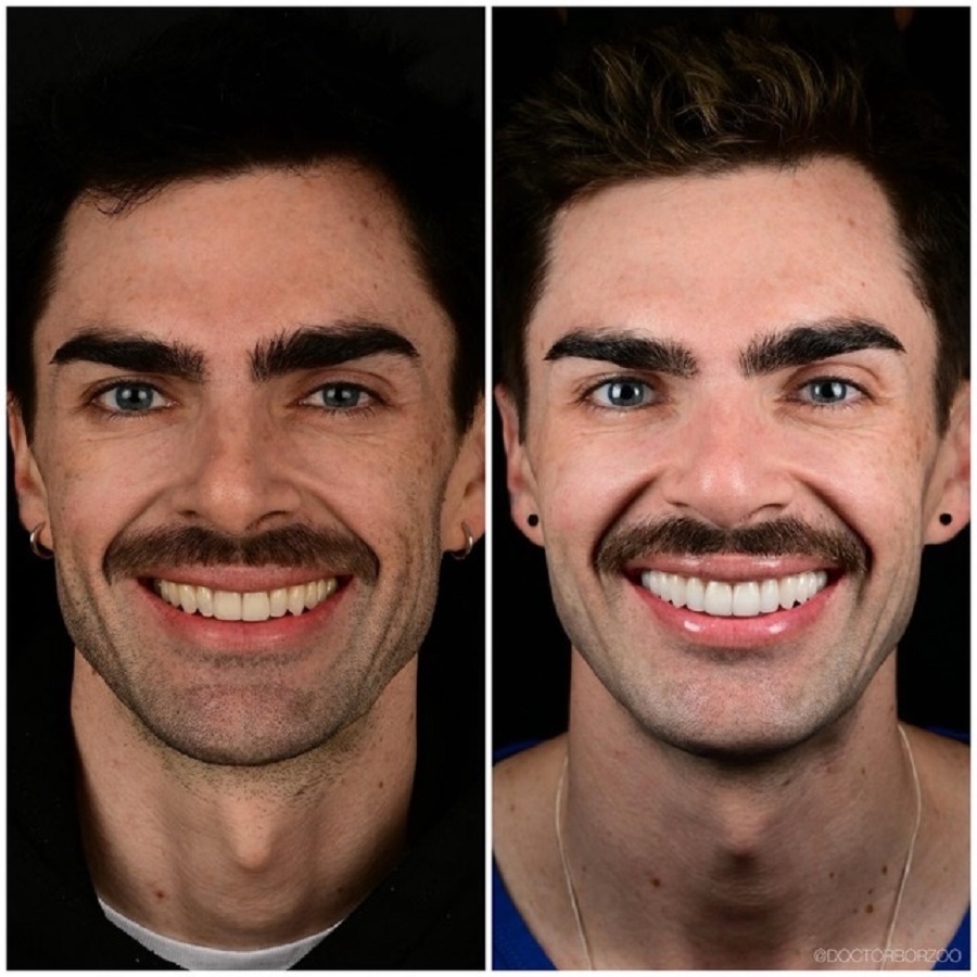 Dr. Borzoo Ahmadi DDS - Cosmetic Dentist - Gallery 4