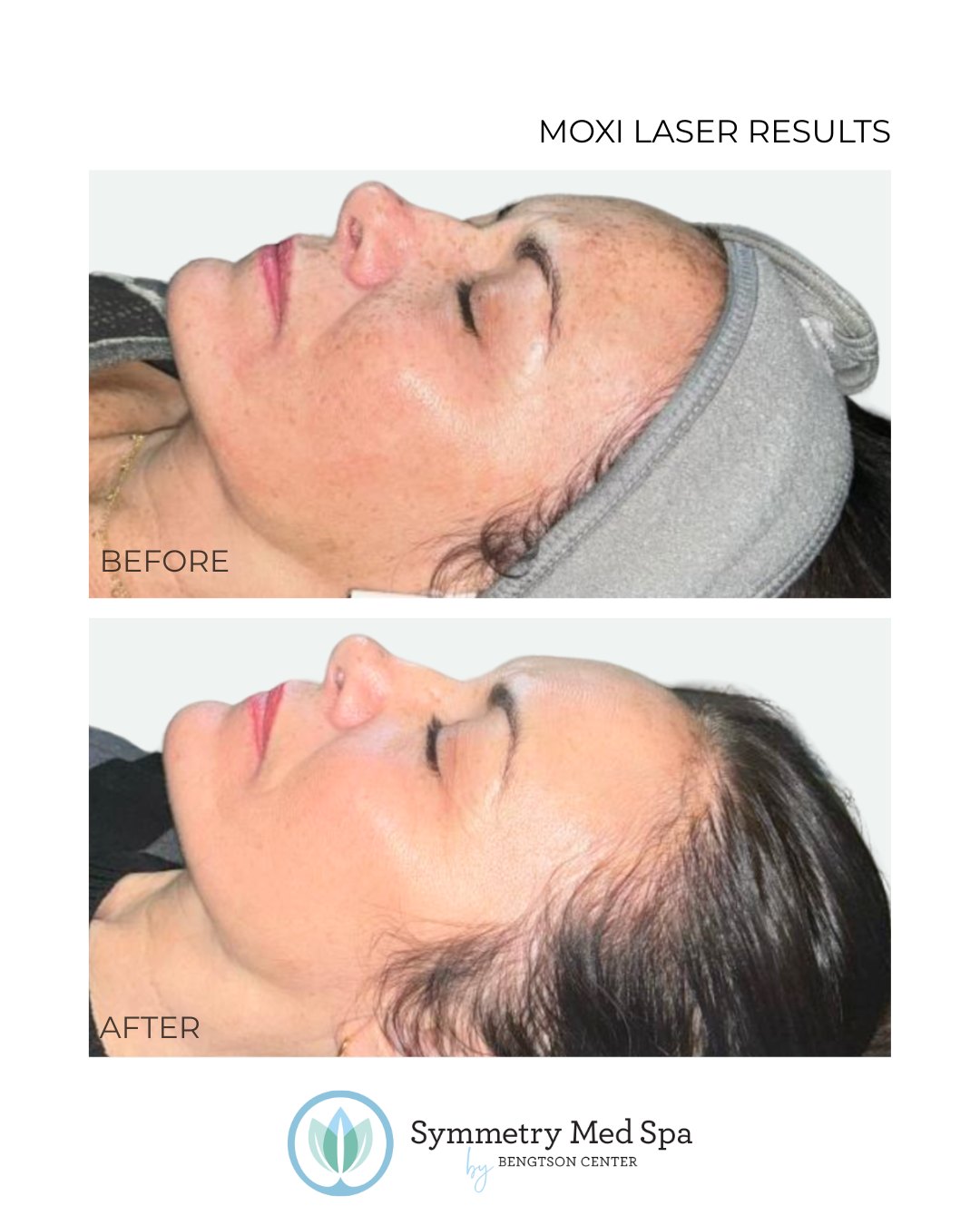 Bengtson Center for Aesthetics & Plastic Surgery - Gallery 1