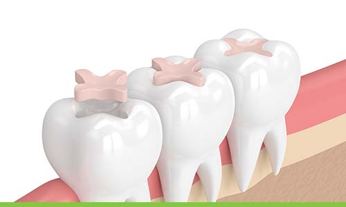 Serenity Smiles Dental - Gallery 4