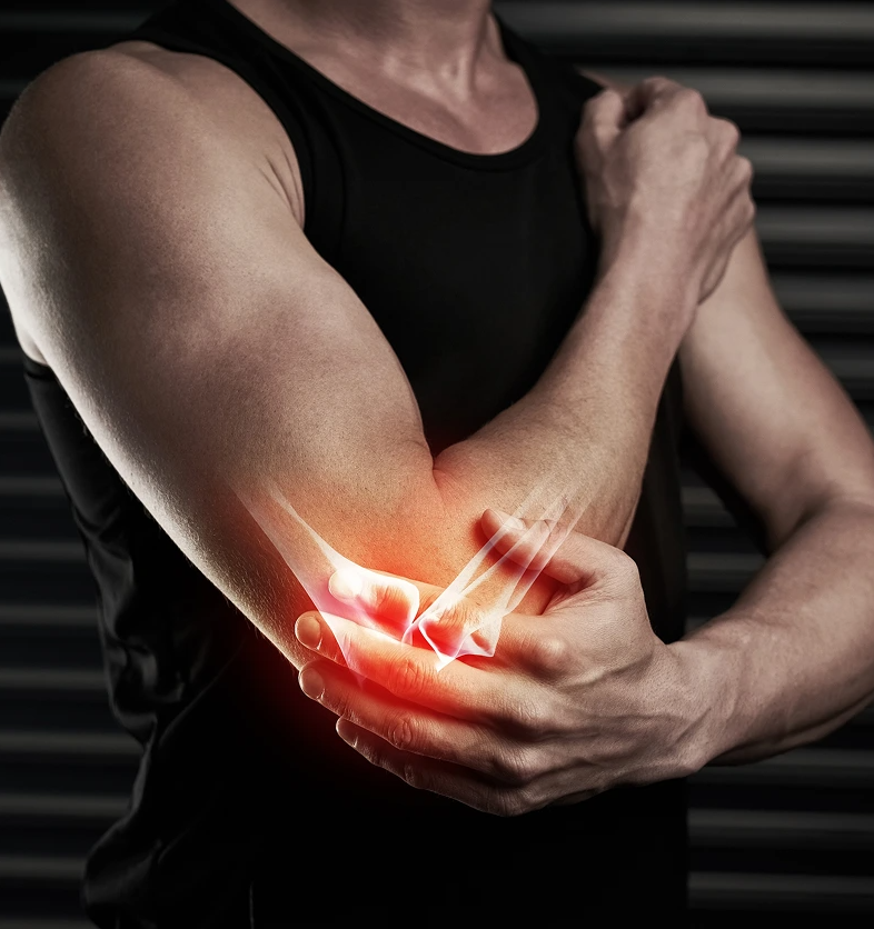 Nervexa™ - Gallery 1