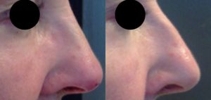 Skin & Laser Clinic Armadale, Melbourne - Gallery 6