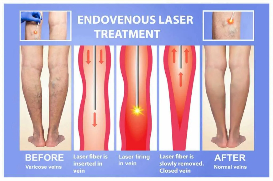 Northbrook Rosen Vein Care - Gallery 2
