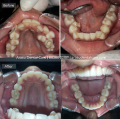 Arasu Dental Care - Gallery 3