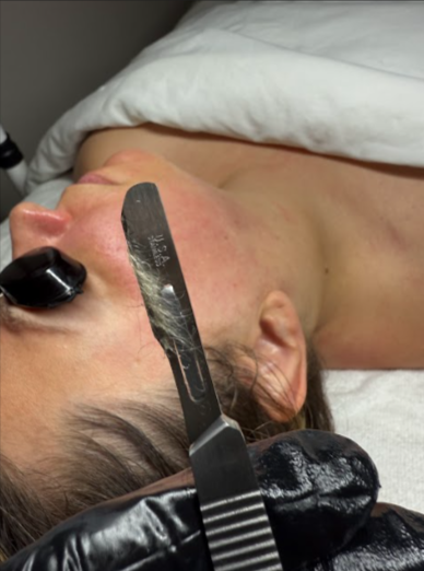 Skin Bliss Med Spa - Gallery 12