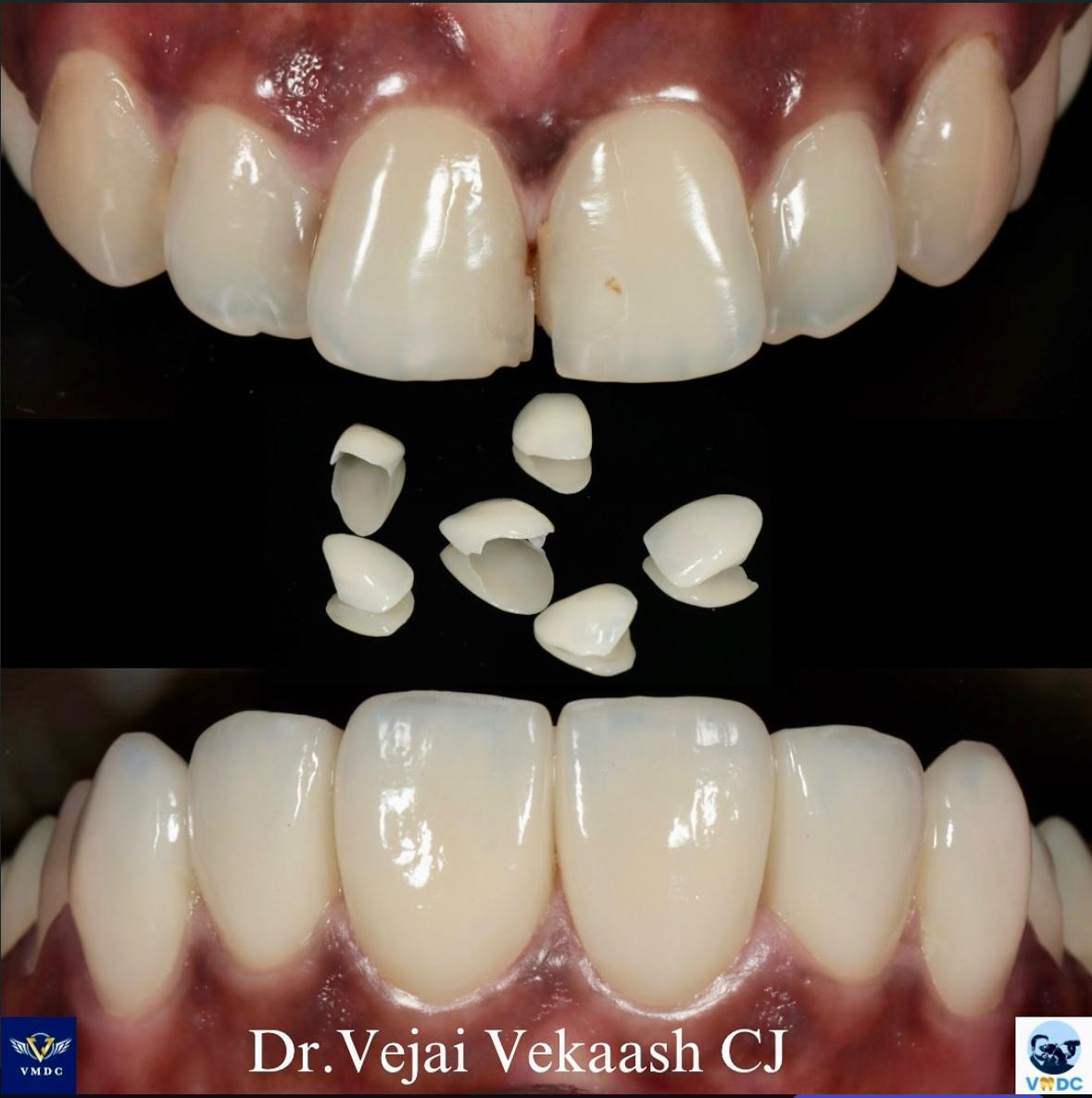 vejai Micro Dentistry Center - Gallery 7