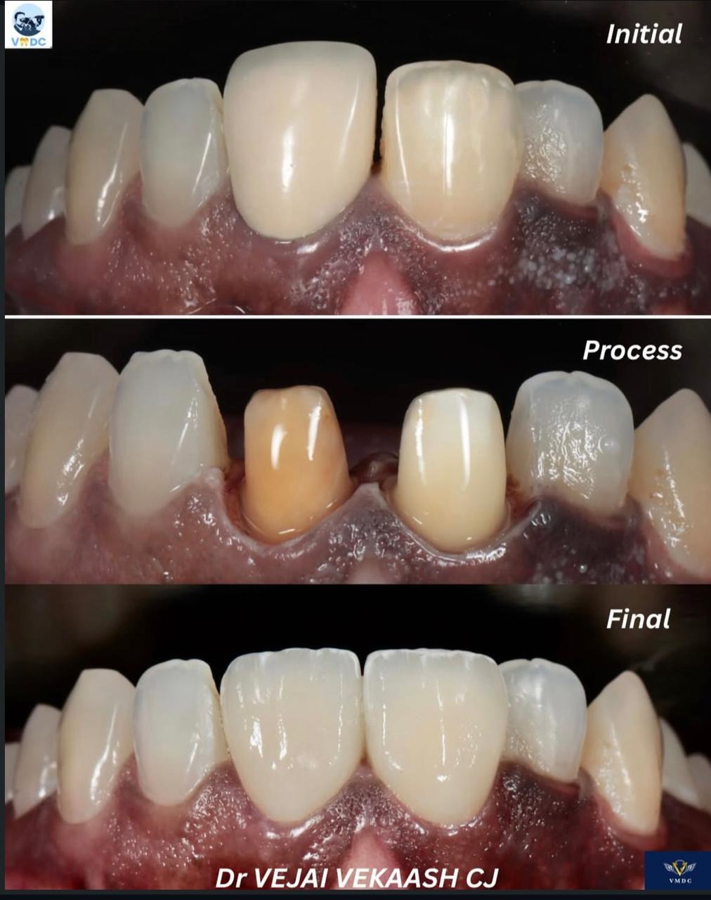 vejai Micro Dentistry Center - Gallery 6