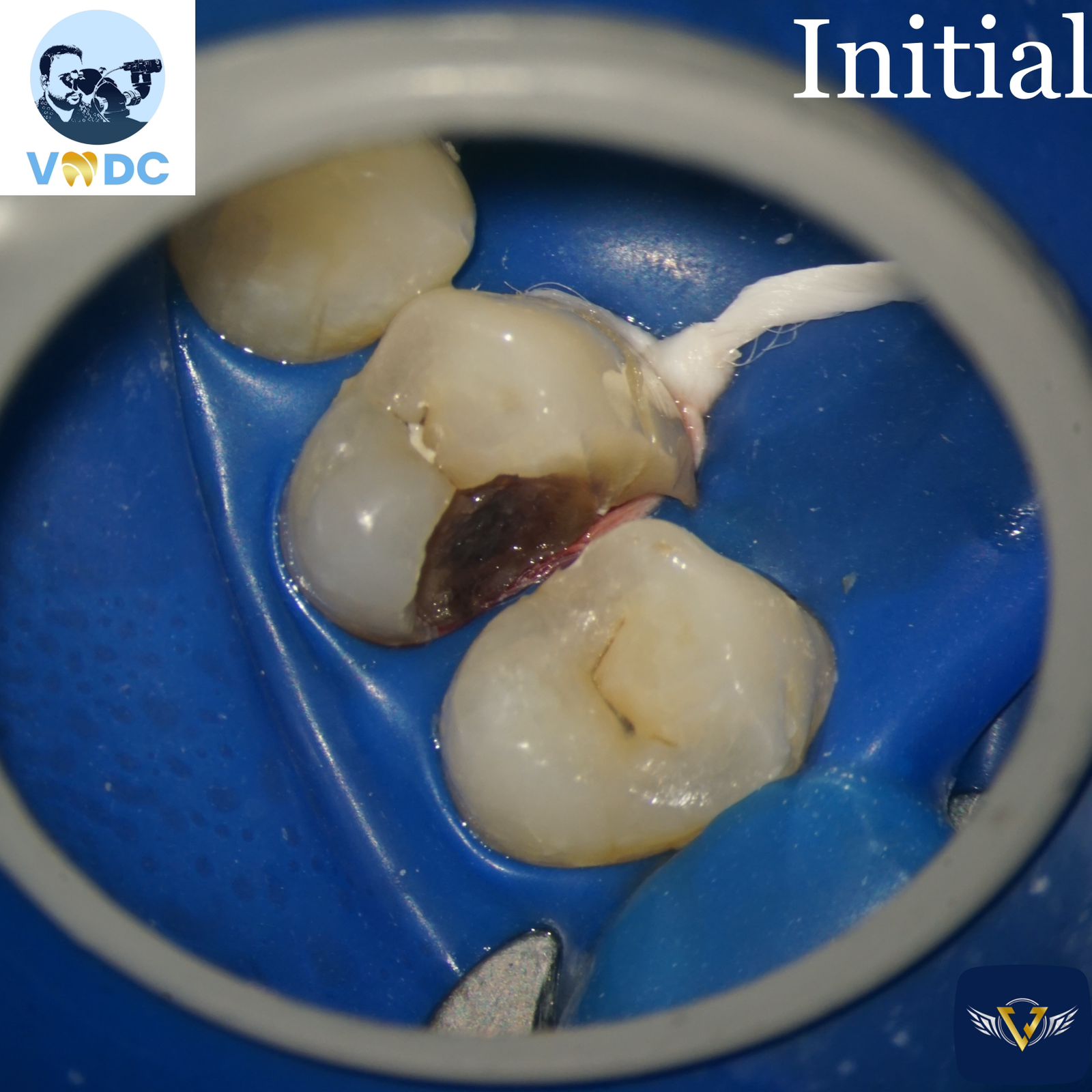 vejai Micro Dentistry Center - Gallery 2