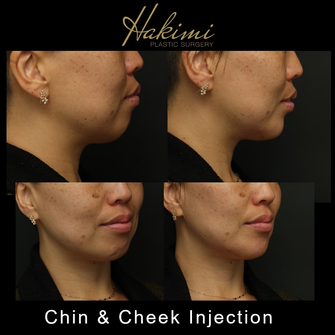 Hakimi Plastic Surgery - Gallery 2