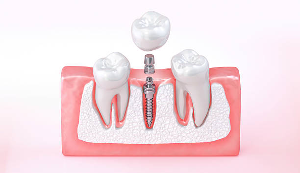 Mindarie Quinns Dental Centre - Gallery 2