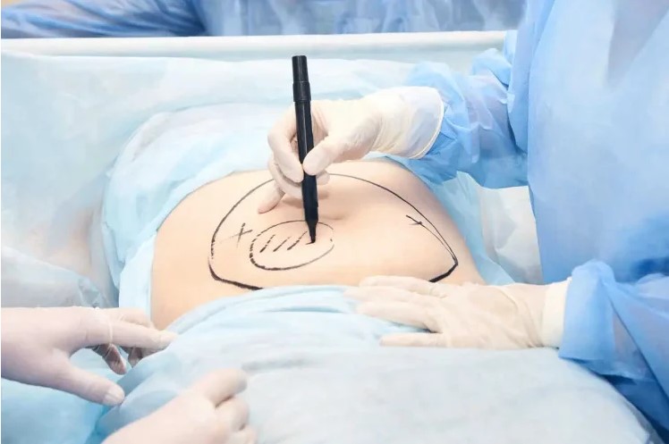 Silk Touch Cosmetic Surgery, Lipo, & Medspa - Gallery 5