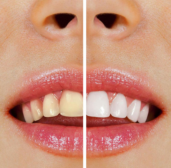 Dentist Warrnambool - Warrnambool Dental - Gallery 3