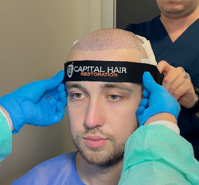 Capital Hair Restoration - Hair Transplant - Gallery 2
