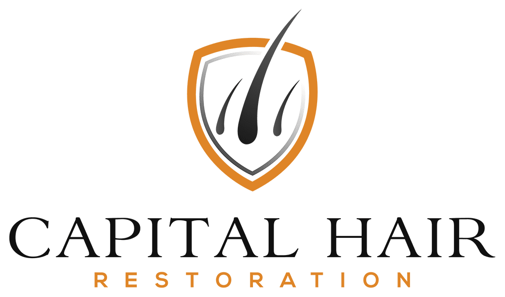 Capital Hair Restoration - Hair Transplant - Gallery 1