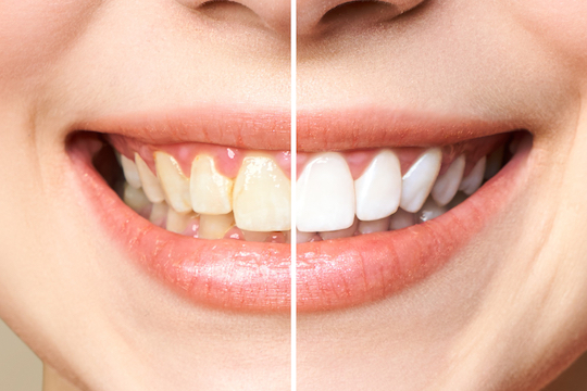 Dentist Warrnambool - Warrnambool Dental - Gallery 4